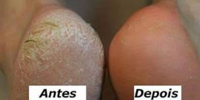 Spa Dos Pés Com Pedicure