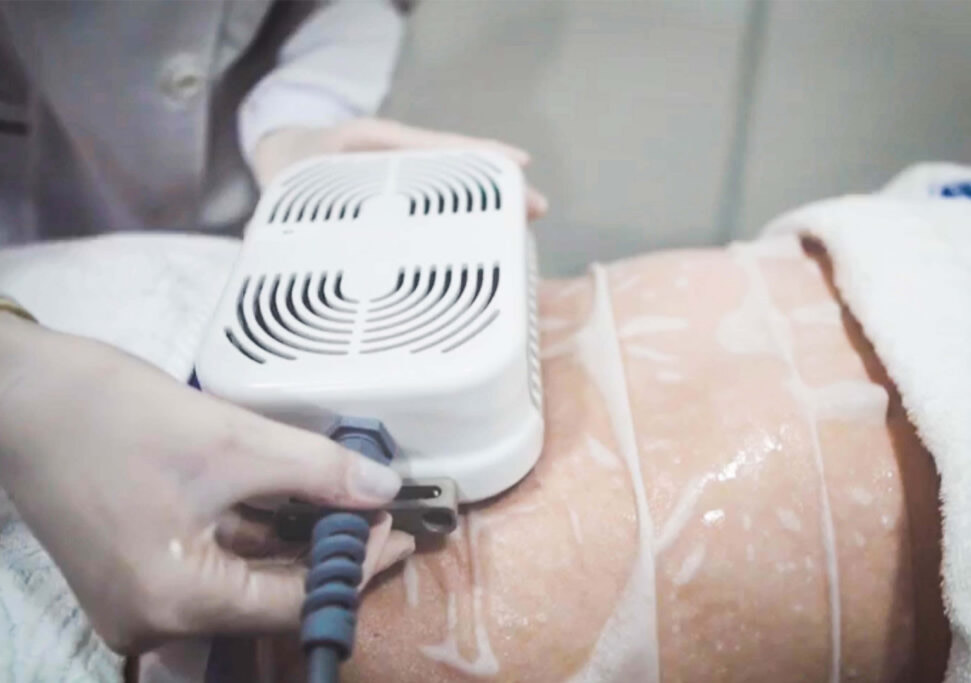 Criolipolise 3 Placas + Massagem Modeladora